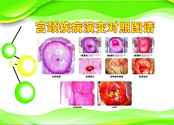 运城现代妇科医院