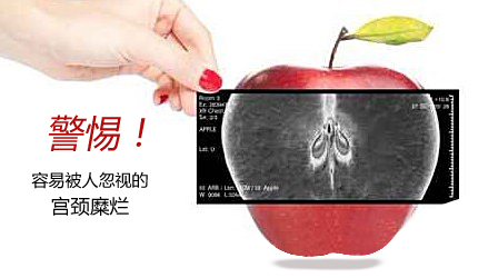 运城治疗宫颈腐烂医院